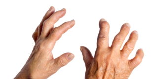 How to Use Paraffin Therapy in the Clinic