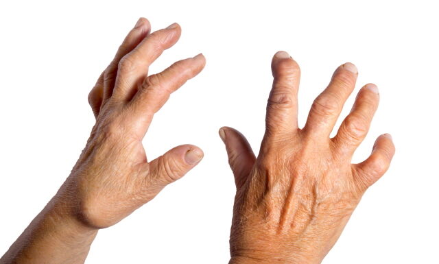 How to Use Paraffin Therapy in the Clinic