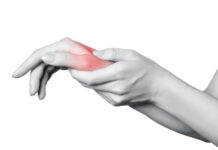 What is the best way to treat Carpal tunnel syndrome?