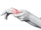 What is the best way to treat Carpal tunnel syndrome?