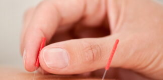 Clinical Application of Saam acupuncture (Four Points Acupuncture) (2)