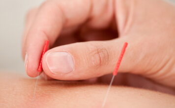 Clinical Application of Saam acupuncture (Four Points Acupuncture) (2)