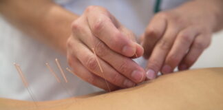 Clinical Application of Saam acupuncture (Four Points Acupuncture) (3)