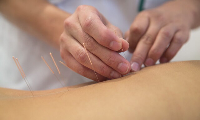 Clinical Application of Saam acupuncture (Four Points Acupuncture) (3)