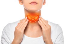 Treating Hyperthyroidism with Herbs