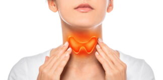 Treating Hyperthyroidism with Herbs