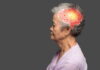 Acupuncture is a Tonic for Giving Vitality To The Brain Function