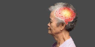 Acupuncture is a Tonic for Giving Vitality To The Brain Function