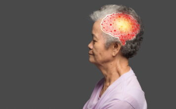 Acupuncture is a Tonic for Giving Vitality To The Brain Function
