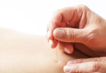 How To Apply Saam Acupuncture Technique Effectively and Easily
