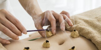 Medical Therapies of TKM-Moxibustion, Cupping, Qigong