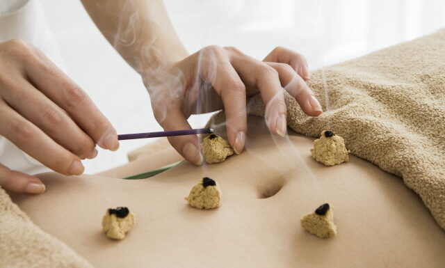 Medical Therapies of TKM-Moxibustion, Cupping, Qigong
