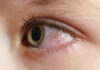Understanding LI Meridian For Saam Acupuncture