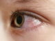 Understanding LI Meridian For Saam Acupuncture