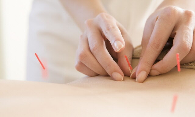 General Guide for Korean Acupuncture &Moxibustion