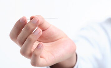 General Guide for Korean Acupuncture &Moxibustion (2) Method of Acupuncture Treatment