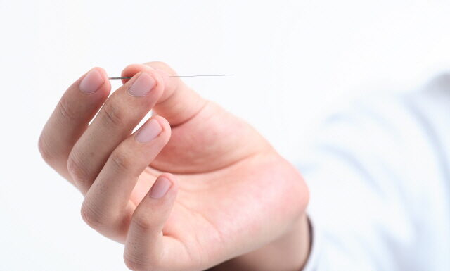 General Guide for Korean Acupuncture &Moxibustion (2) Method of Acupuncture Treatment