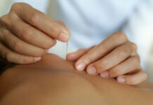 Four Needles, Five Elements and Six Qi: Treatment using Korean SaAm Acupuncture