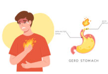 Healing Barret’s Esophagus with Korean Herbal Medicine: A Case Study