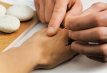 Understanding Saam Acupuncture: SI Meridian