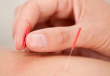 Korean, Japanese and Chinese Acupuncture: What’s the Difference?