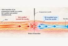 Underlying Theories of Acupuncture Treatment ① Understanding How Qi Moves Through the Meridians