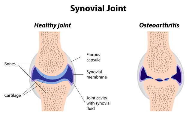 Rehmannia Root: Potential for Osteoarthritis Treatment