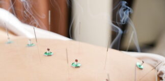 DONGUIBOGAM; Internal Bodily Elements 33. Parasites 蟲 충 (4) Simple Prescriptions, Acupuncture and Moxibustion