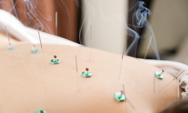 DONGUIBOGAM; Internal Bodily Elements 33. Parasites 蟲 충 (4) Simple Prescriptions, Acupuncture and Moxibustion