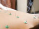 DONGUIBOGAM; Internal Bodily Elements 33. Parasites 蟲 충 (4) Simple Prescriptions, Acupuncture and Moxibustion