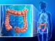 DONGUIBOGAM; Internal Bodily Elements 38. Feces 大便 대변-The Causes of Feces Disease