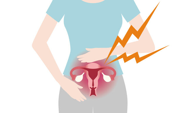 Herbal Medicine Approaches for Chronic and Recurrent Leukorrhea