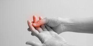 Chemotherapy-Induced Neuropathy: An Acupuncture-Based Clinical Approach