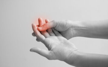 Chemotherapy-Induced Neuropathy: An Acupuncture-Based Clinical Approach