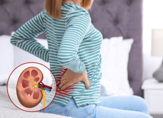 Discharge Gall Stones and Kidney Stones