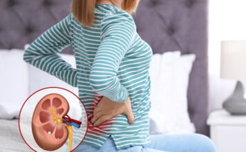 Discharge Gall Stones and Kidney Stones