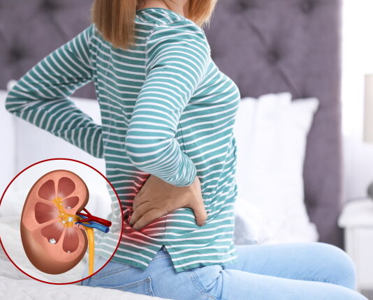 Discharge Gall Stones and Kidney Stones