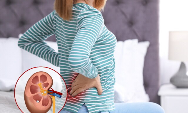 Discharge Gall Stones and Kidney Stones