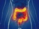 DONGUIBOGAM; Internal Bodily Elements 49. Feces (13) Stopping Intestinal Disorders: 70 Herbal Prescriptions and Acupuncture Treatments