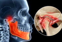 Tung’s Acupuncture for TMJ and Oral Disorders