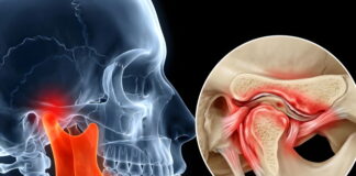 Tung’s Acupuncture for TMJ and Oral Disorders
