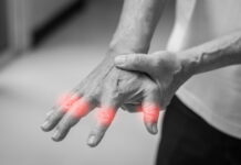 Effective Treatment of Finger and Wrist Pain Using Tung’s Points