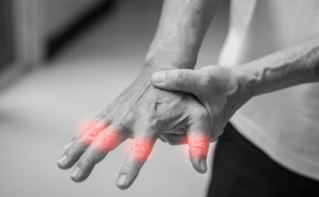 Effective Treatment of Finger and Wrist Pain Using Tung’s Points