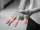 Effective Treatment of Finger and Wrist Pain Using Tung’s Points