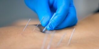 Physical Therapists’ Dry Needling Bill AB 2497 Defeated on California Assembly Floor