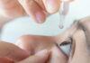 Clinical Applications of Tung’s Acupuncture for Eye Disorders