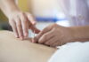 Acupuncture Treatment for the Side Effects of Chemotherapy