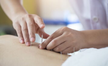 Acupuncture Treatment for the Side Effects of Chemotherapy