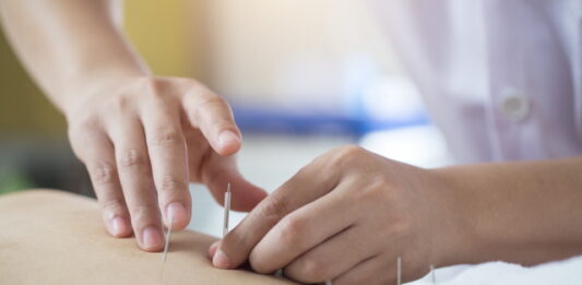 Acupuncture Treatment for the Side Effects of Chemotherapy