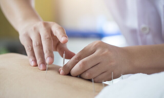 Acupuncture Treatment for the Side Effects of Chemotherapy